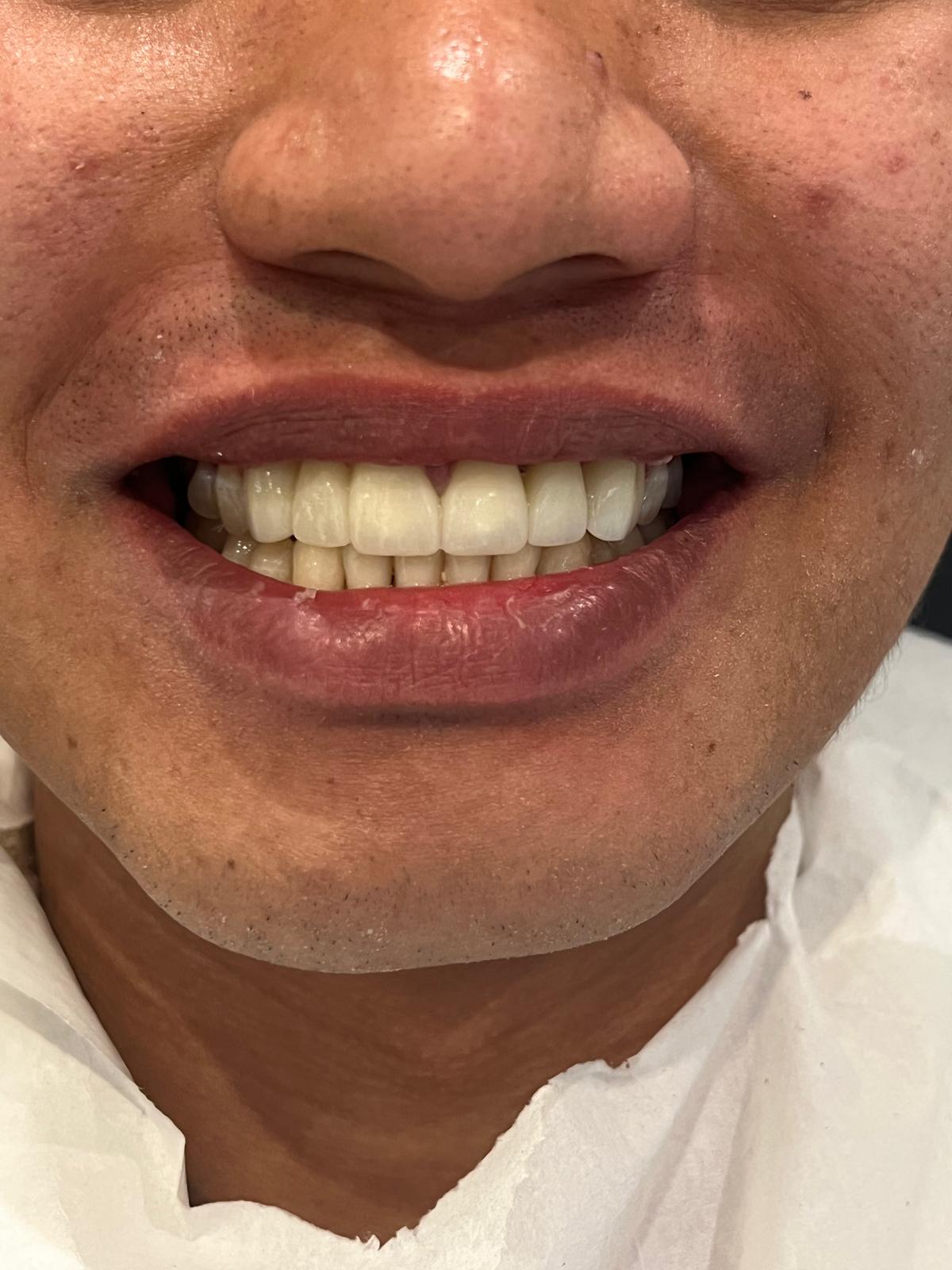 ECE Dental Patient Transformation
